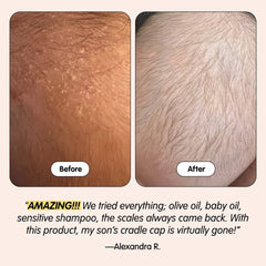 Tubby Todd Cradle Cap 1.8 fl oz